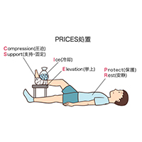 捻挫